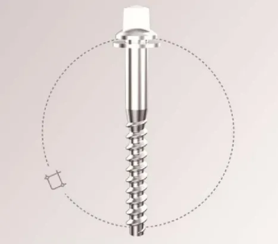 rail fastening rail fastening